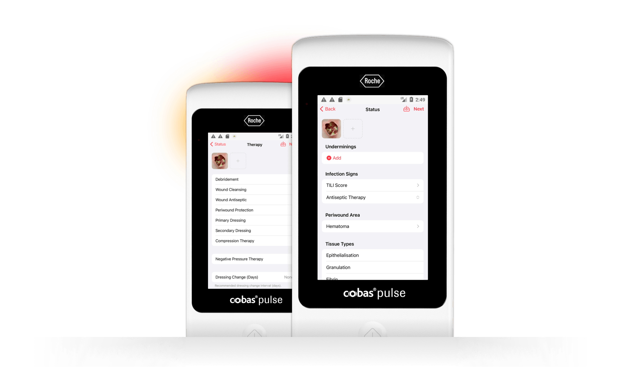 Two cobas® pulse devices displaying the imitoWound application, enabling standardized wound documentation with preset options and free text fields.