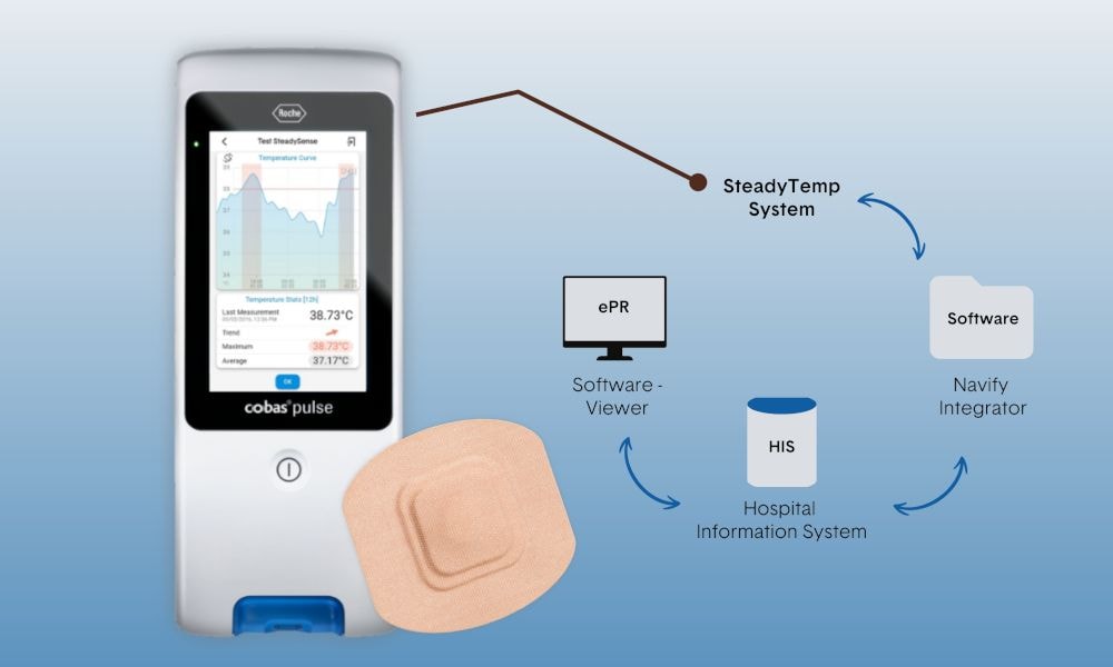 The cobas® pulse displays SteadyTemp temperature curve and graphic with SteadyTemp integration in hospital information system