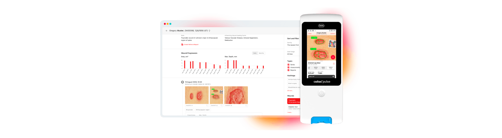 A digital wound assessment tool displayed on a computer and cobas® pulse device.