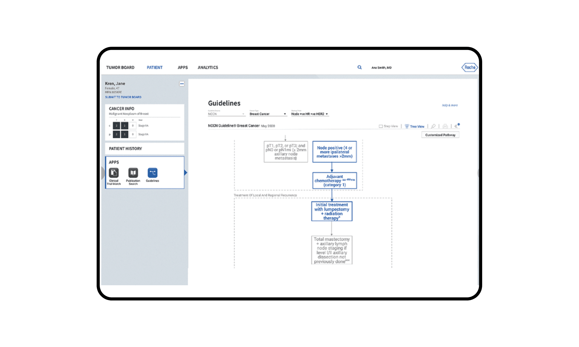 Computer screen outline with tumor board user interface.