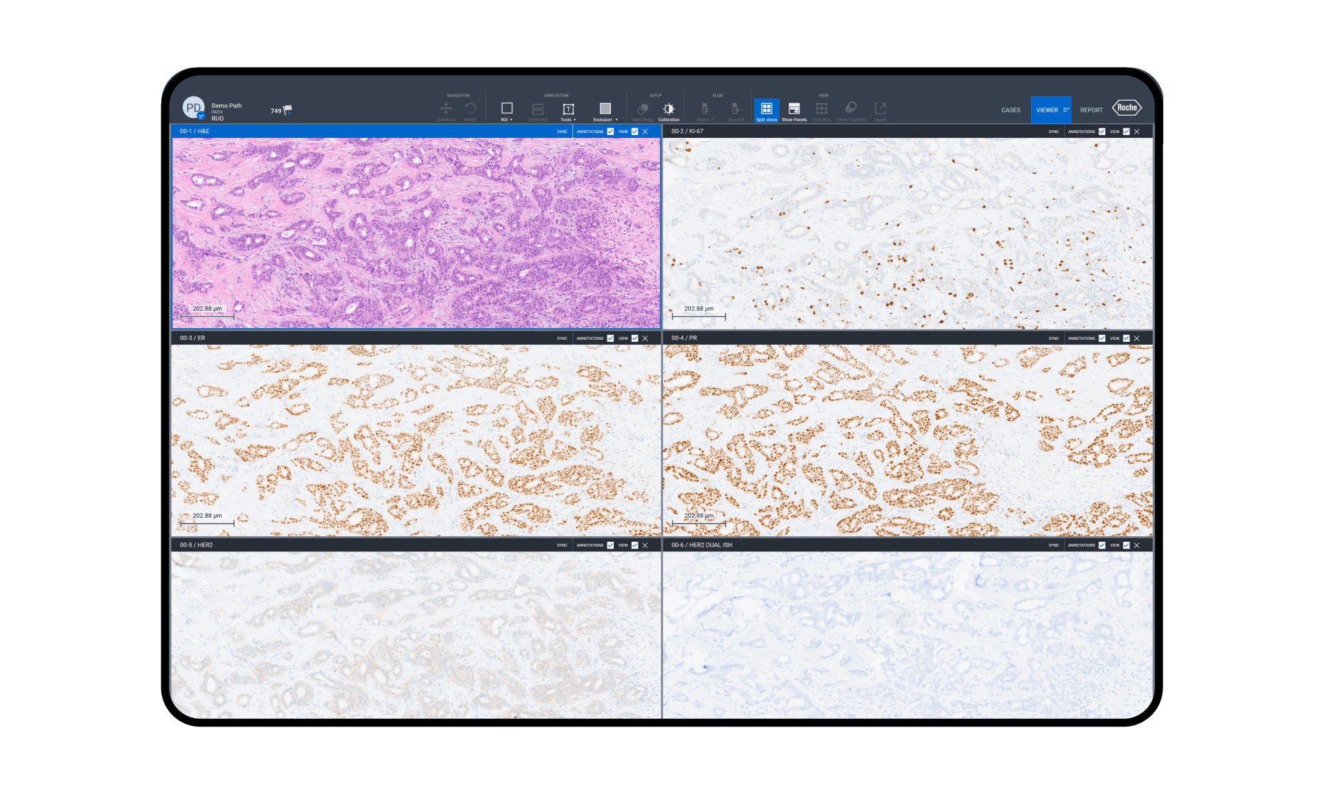 UI screen displaying a multi-slide canvas.