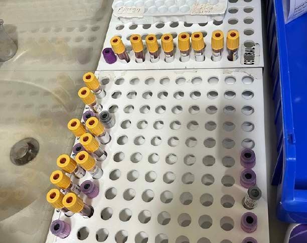 Close-up of test tubes organized on a laboratory tray, prepared for analysis or transportation.